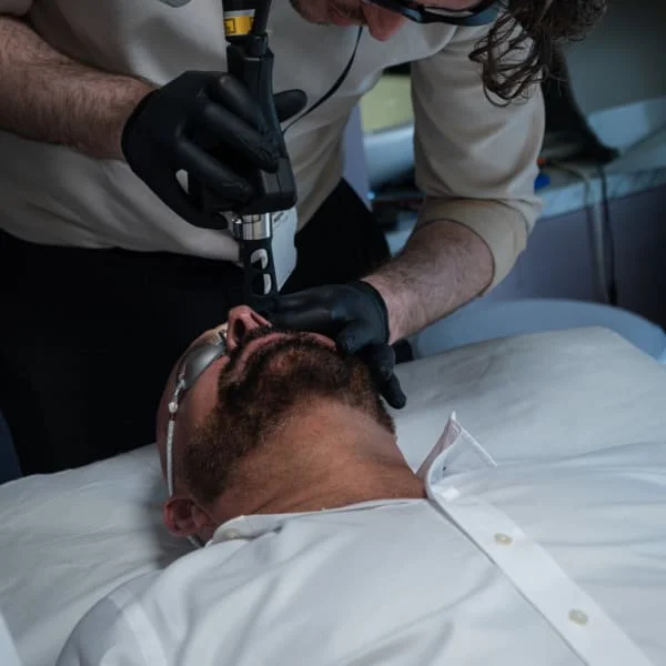 HIFU Treatment