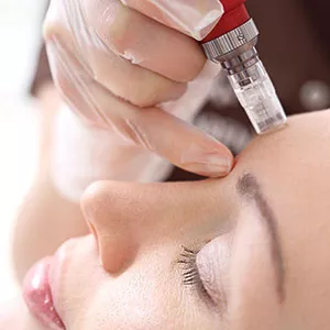 Focus Dual (HIFU and RF Microneedling)